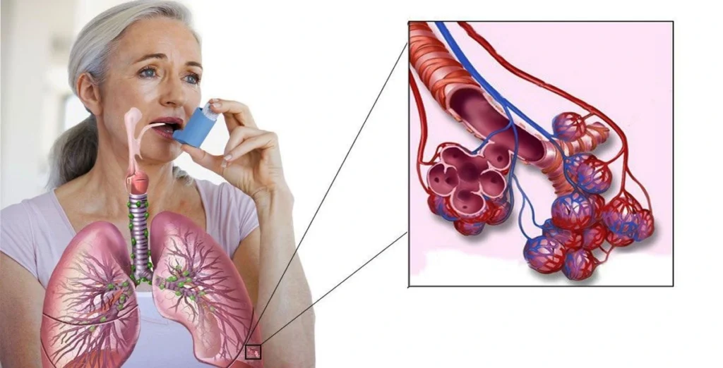 treatment guidelines for asthma