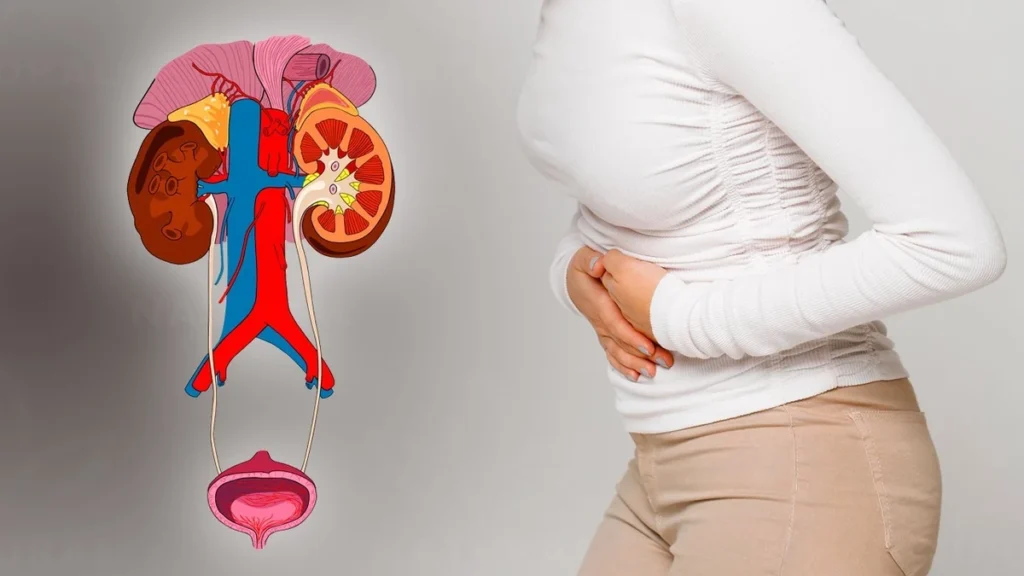 icd 10 urinary tract infection, wmc