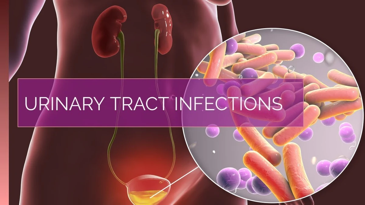 urinary tract infection, wmc