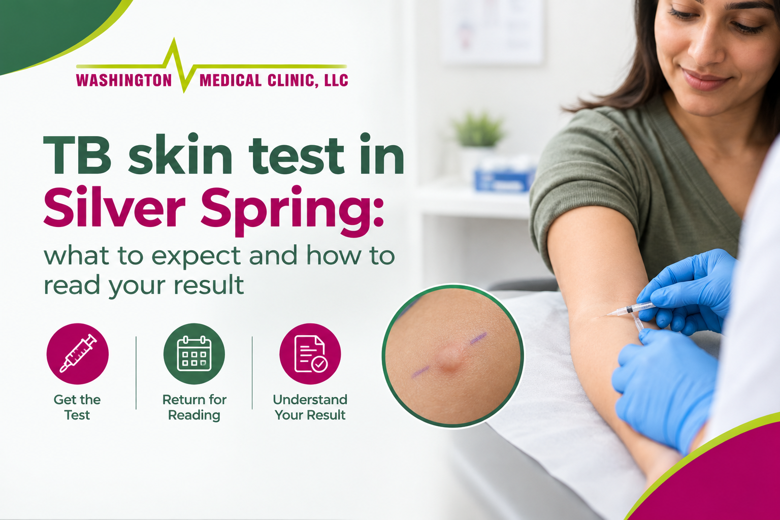 TB Skin Test Guide in Silver Spring, wmc